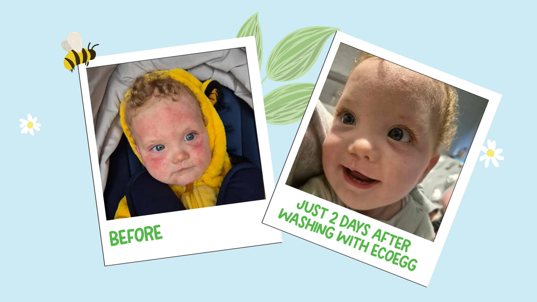 Clark’s Story: Finding Relief for Sensitive Skin