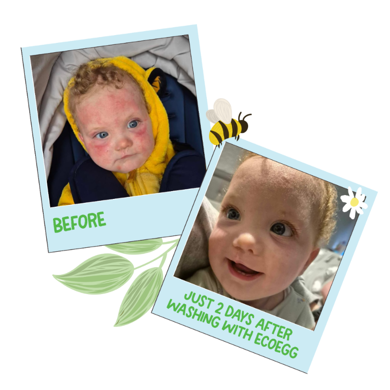 Before and after comparison of a baby's skin condition with Ecoegg products.