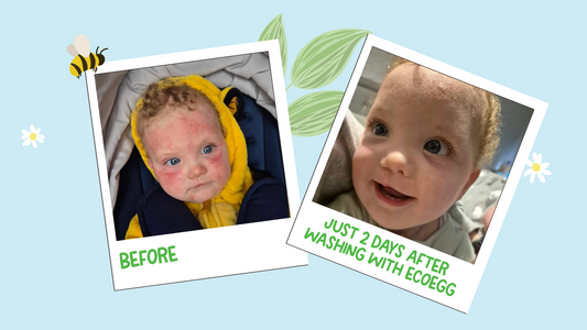 Clark’s Story: Finding Relief for Sensitive Skin